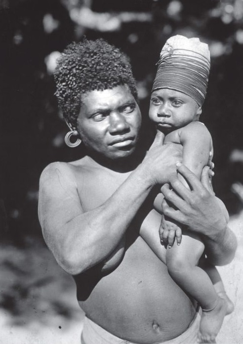 Criança da etnia Vanuatu com crânio enfaixado.
